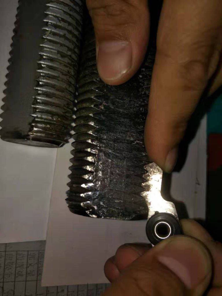 checking-teeth-type